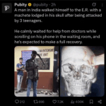 a man in india walked himself to the er with a machete lodged in his skull.png