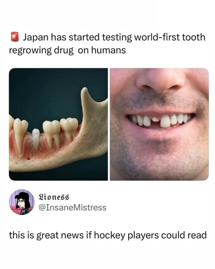 a solution to hockey players.jpeg