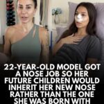 22 year old model got a nose job so her future children would inherit her new nose.jpeg