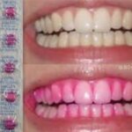 those pink tablets you ate to see where you missed brushing your teeth.jpeg