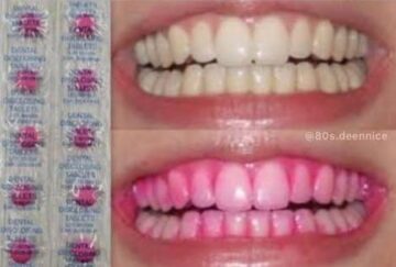 those pink tablets you ate to see where you missed brushing your teeth.jpeg
