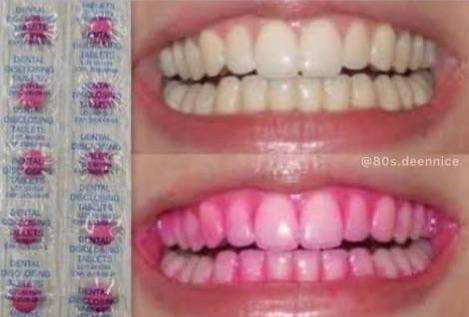 those pink tablets you ate to see where you missed brushing your teeth.jpeg